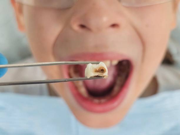 Best Emergency Tooth Extraction  in Lake Hallie, WI